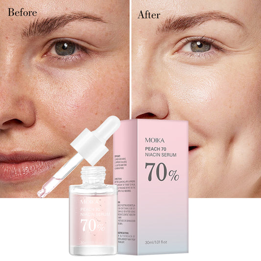 Anua - Niacin & Hyaluronic Serum (Peach + Niacin) (Original)