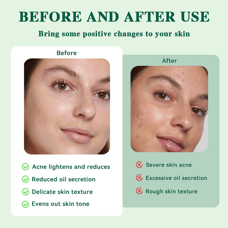 The Miracle Starter Kit (Original)