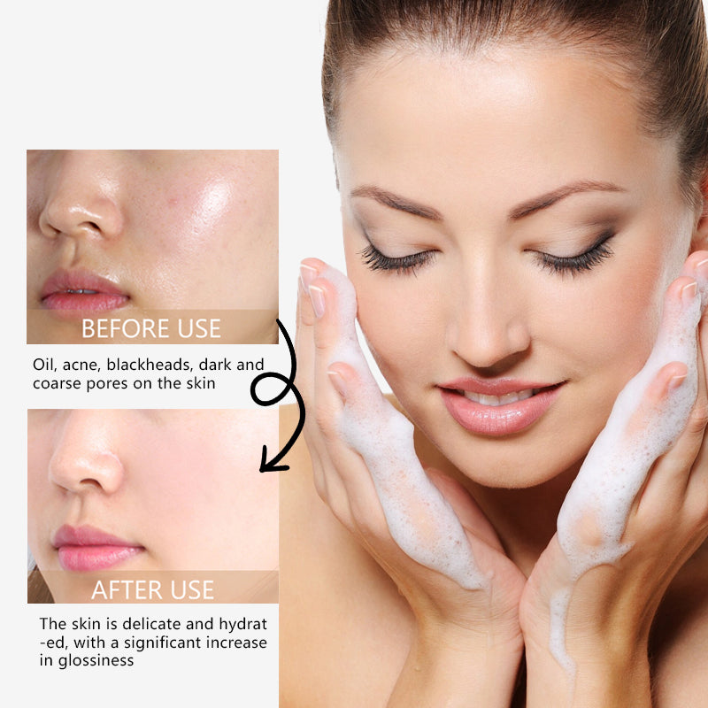 Crosrx - Gel Cleanser Low PH (Original)